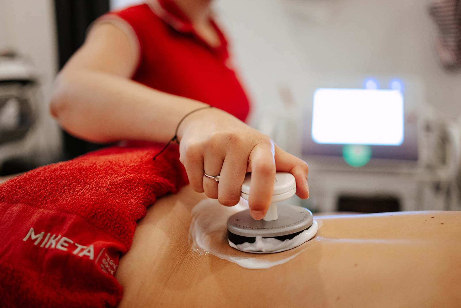 Išijas tecar terapija